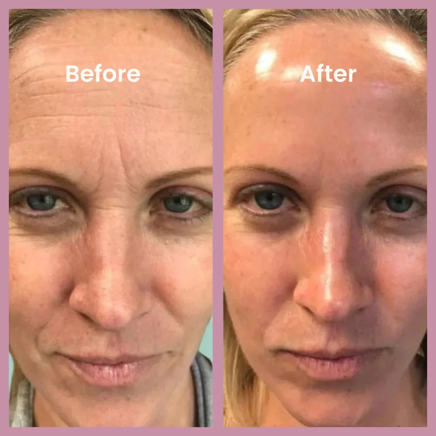 Organic Collagen Mask – The Korean Beauty Secret – Clarilys™
